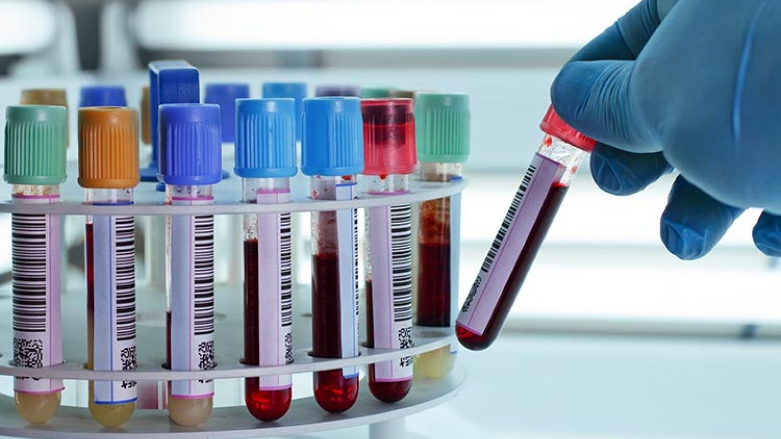 In this publication, we discuss real-time fluorescence flow cytometry.